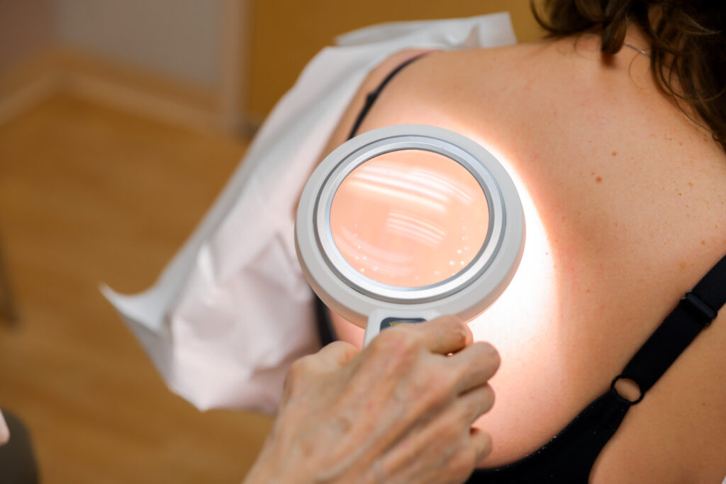 An example of a specialist performing a skin exam for the best preventative skincare near Elgin, IL.
