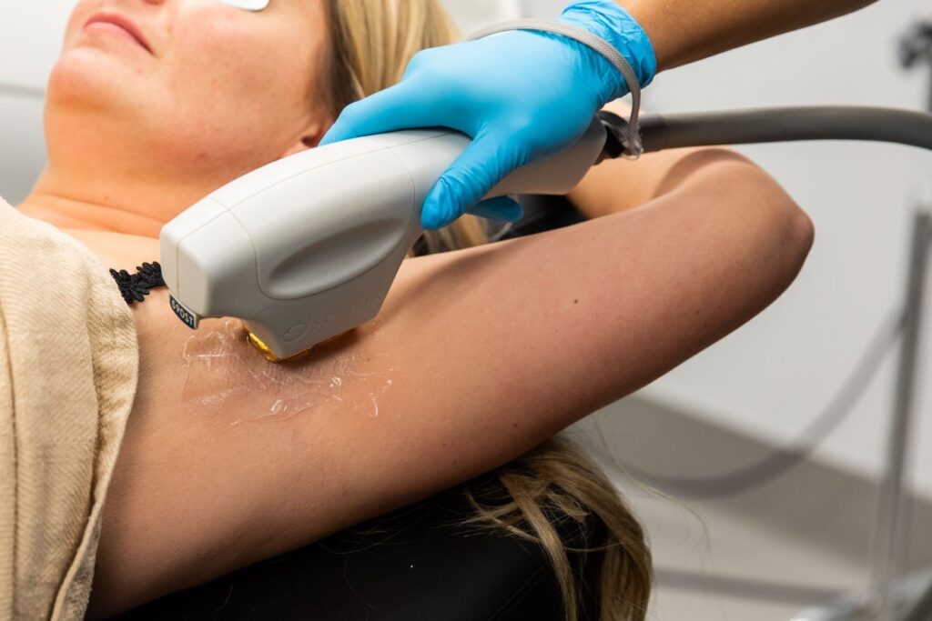 A woman sits back as a provider performs laser hair removal near Elgin, IL on her armpit.
