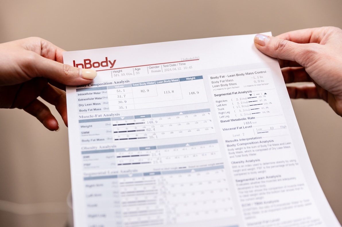 A female patient's hands holding her results sheet after a scan with Inbody in Elgin at Dundee Dermatology.